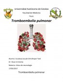 Como Tombo embolia pulmonar