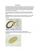 Tricocefalosis. Ciclo de vida