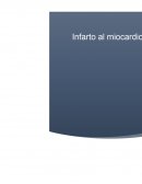 Infarto al miocardio es un patología que afecta tanto a hombres como a mujeres