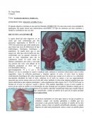 PATOLOGÍA BENIGNA ANORECTAL