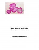 Como se da el Parasitología y micología