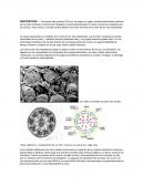 Discinesia ciliar primaria (PCD por sus siglas en inglés)