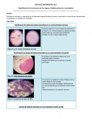 Identificación de la estructura de los órganos linfoides primarios y secundarios