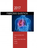 Ensayo de fibrosis pulmonar quistica