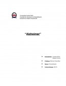 Enfermedad Alzheimer