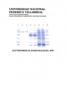 ELECTROFORESIS DE ACIDOS NUCLEICOS: ADN