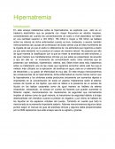 Hipernatremia