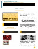 Rehabilitacion sobre implantes