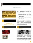 Rehabilitacion sobre implantes