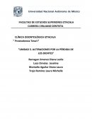 Alteraciones por la pérdida de los dientes
