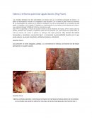 Edema y enfisema pulmonar agudo bovino (Fog Fever)