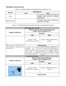 Hongos y microorganismos microscopio