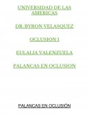Palancas en oclusion