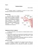 Embarazo Ectopico (o extrauterino)