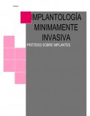 IMPLANTOLOGIA MINIMAMENTE INVASIVA