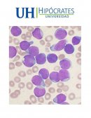 PREVALENCIA Y CALIDAD DE VIDA EN LA LEUCEMIA LINFOBLASTICA L1 EN PACIENTES PEDIATRICOS MENORES DE 4 AÑOS EN EL IECAN