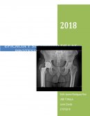 Artoplastia de cadera