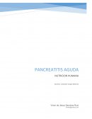 Nutricion Pancreatitis Aguda