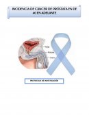 INCIDENCIA DE CÁNCER DE PRÓSTATA EN DE 40 EN ADELANTE