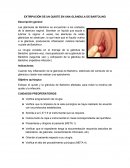 EXTIRPACIÓN DE UN QUISTE EN UNA GLÁNDULA DE BARTOLINO