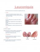 Enfermedades de la uña