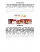 Lesión de furca. Etiología y diagnóstico