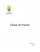 Cáncer de Pulmón . Pasos mentales