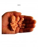 Aborto. Que sucede después del aborto instantáneo