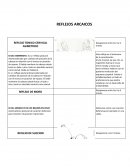 Reflejos del Recien Nacido