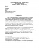 Flebografia anormal
