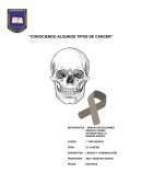 Conociendo algunos tipos de cancer