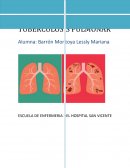 TUBERCULOSIS PULMONAR