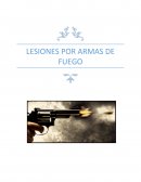 Lesiones por armas de fuego