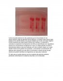 Biologia electroforesis