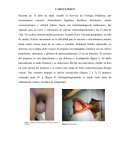 Caso Clínico Efimosis