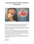 Hemorragia Subanaracnoidea y Aneurismas Intracraneales