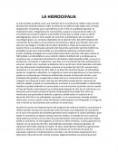 Ensayo la hidrcefalia