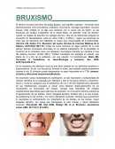 Bruxismo
