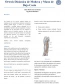 Ortesis Dinámica de Muñeca y Mano de Bajo Costo