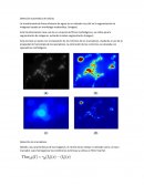 Deteccion automatica de celulas