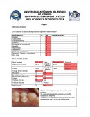 Caso endodoncia