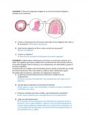 Actividades sobre organos