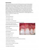 Biotipo gingival