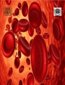 Anemia por deficiencia de hierro o anemia ferropenica