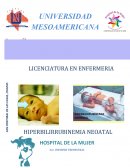 HIPERBILIRRUBINEMIA NEOATAL