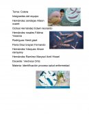 Historia natural del colera