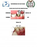 CIRUGIA BUCAL