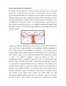 DOLOR PÉLVICO CRÓNICO