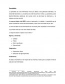 Parotiditis. Tratamiento