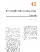 Enfermedad tromboembólica venosa